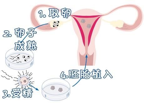 妇科专家